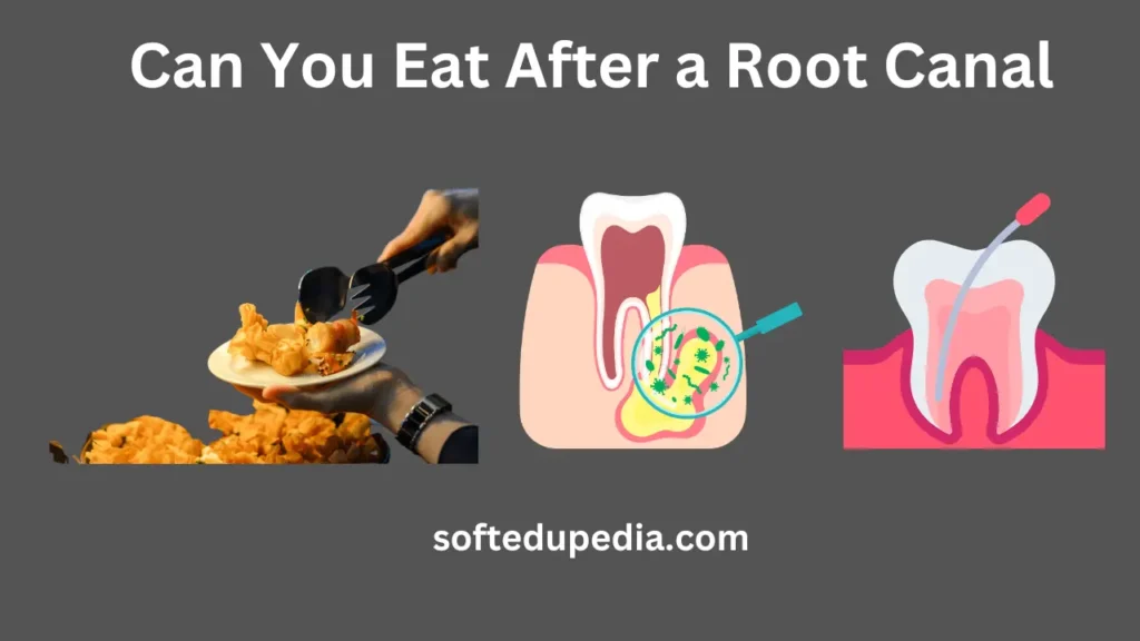 Can You Eat After a Root Canal