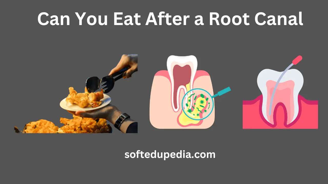 Can You Eat After a Root Canal